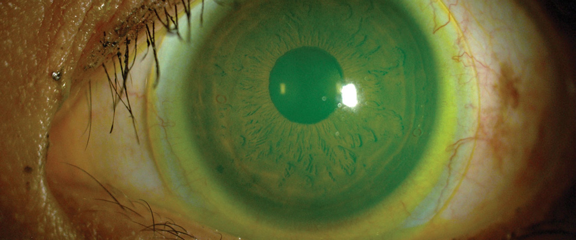 Can Optometrists Provide Specialty Services Such as Scleral Lens Fitting?