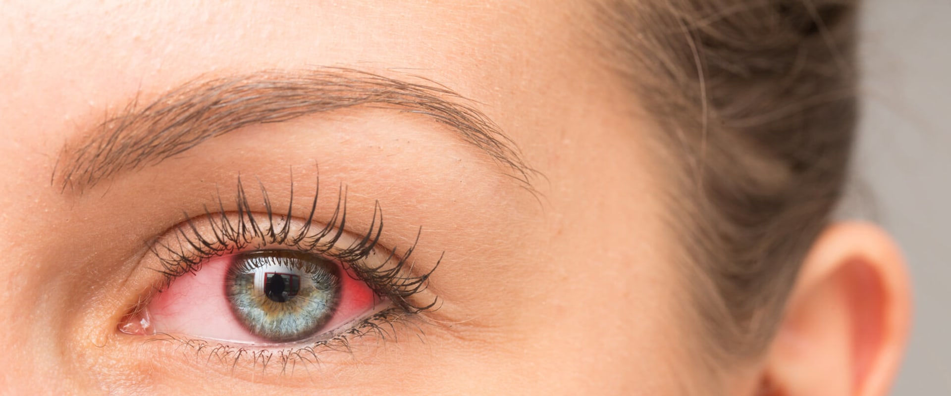 Can an Optometrist Treat Eye Problems?