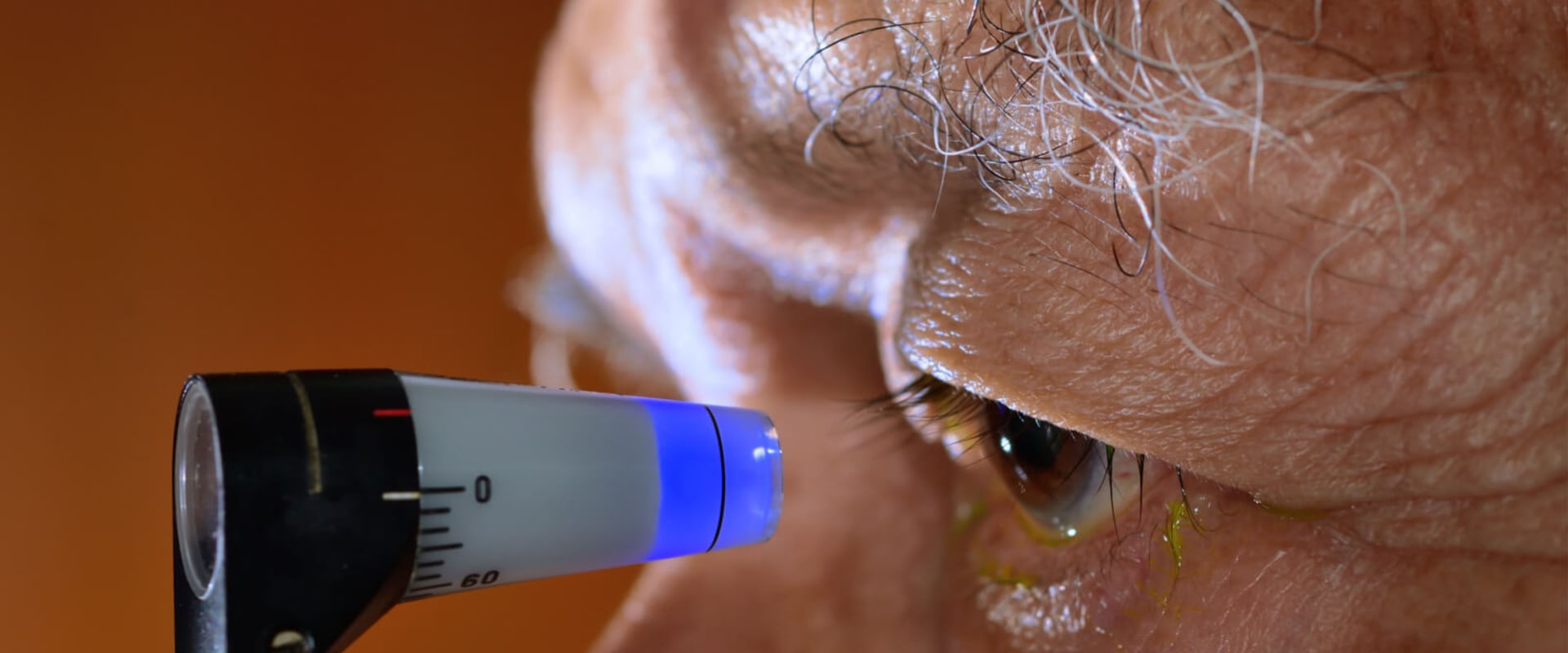Can an Optometrist Diagnose Eye Disease? - An Expert's Perspective