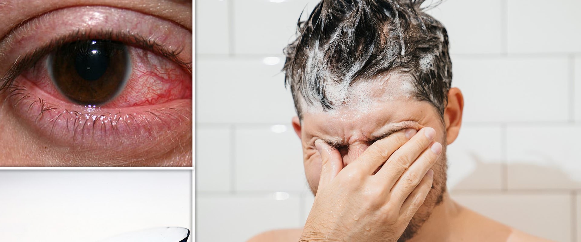 The Dangers of Wearing Contact Lenses: What You Need to Know