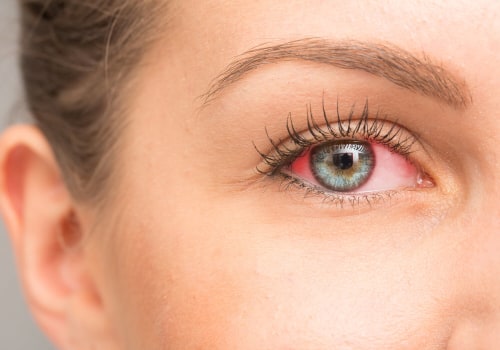 Can an Optometrist Treat Eye Problems?