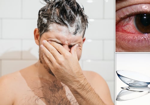 The Dangers of Wearing Contact Lenses: What You Need to Know